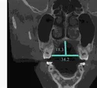 3胱釜ヌ羳嬂腭惴b賄S??觪?x?耺-?+芫鉊W╳F鏐(囊囋囍壄壅壆)